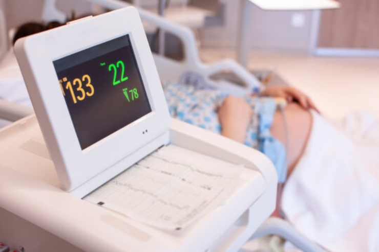 CTG Monitors------15